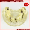 Dental implant study model