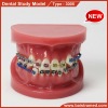 Dental orthodontics study model