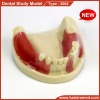 Dental study model/ dental implant practice model